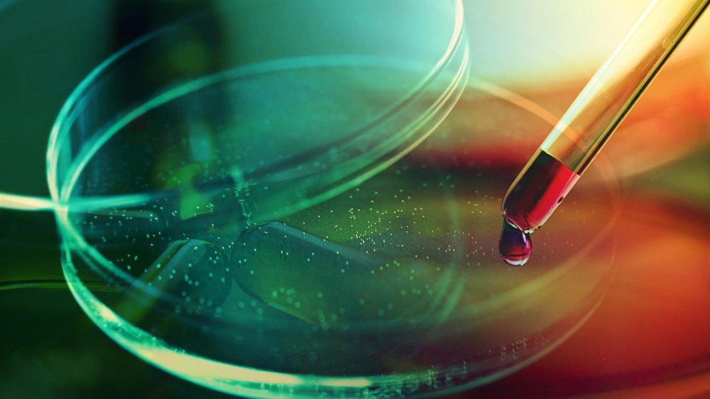  Confirman la primera coinfección por VIH, viruela del mono y covid-19 