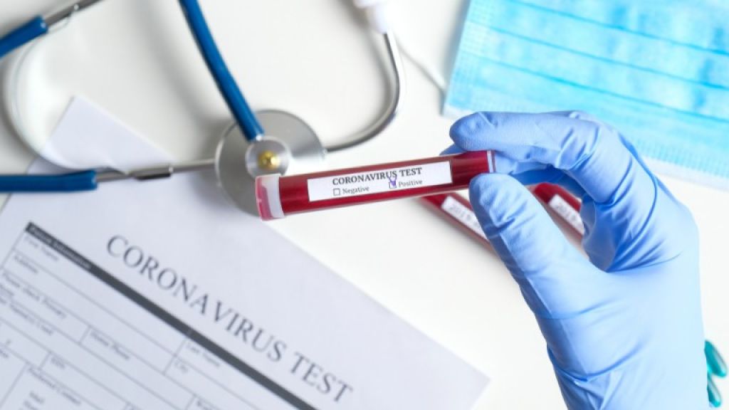  No se reportan muertes en las pasadas 24 horas pero hay 3,030 positivos por COVID-19 