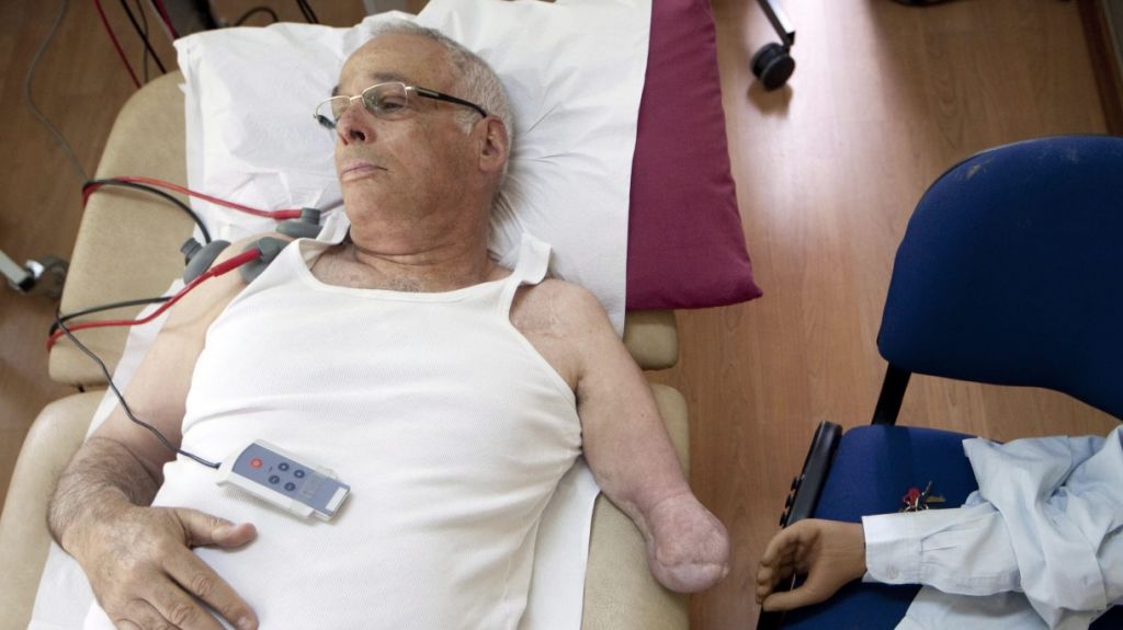  Crean método para restaurar sensación de movimiento en pacientes amputados 