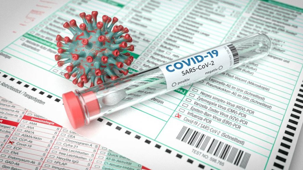  Reporta Salud cuatro muertes y 443 hospitalizaciones por COVID-19 