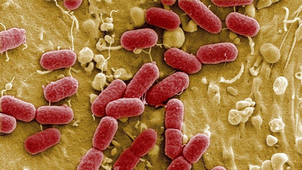  Las autoridades alertan de brote de "E.coli" en cinco estados de E.U. 