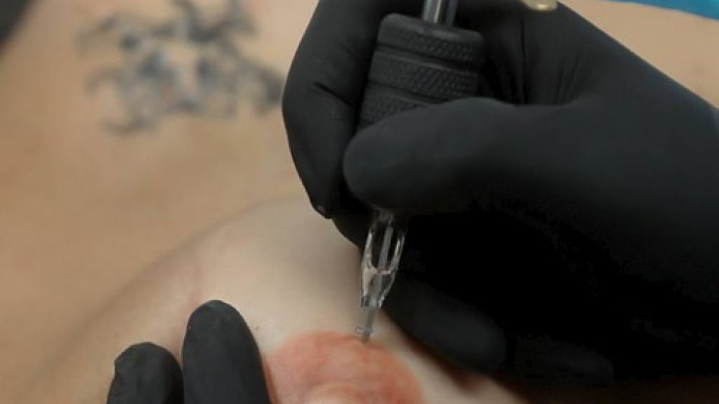  Comisionada residente aboga cobertura completa para reconstrucción de senos incluyendo tatuaje de pezones 