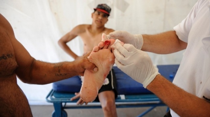 Alrededor de 70 heridos por ataque de peces carnÃ­voros en Argentina