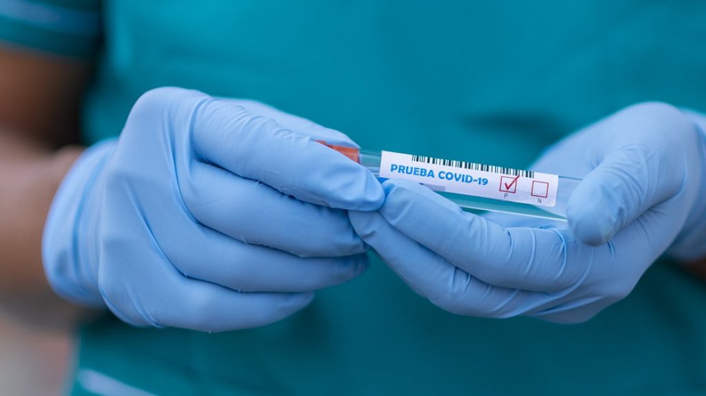  Salud redobla esfuerzos para realizar pruebas masivas de Covid-19 por la Isla 