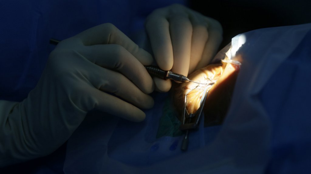  Acusan a oculista de dejar ciegos a pacientes indocumentados 