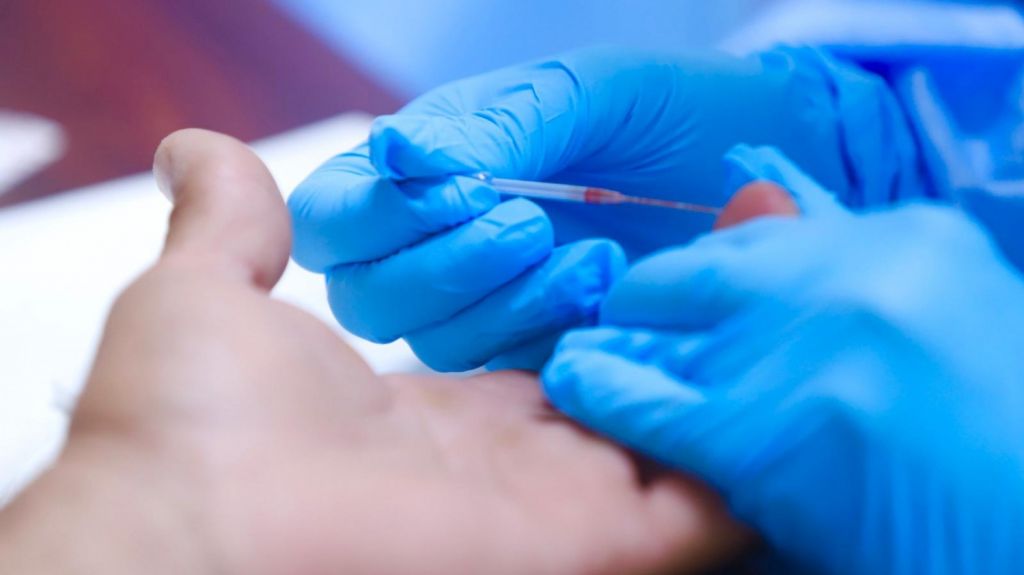  Asciende a 2,542 los positivos por COVID-19 y se registran 122 decesos 