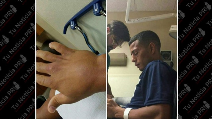 Pugil Boricua "Orlandito" Del Valle peleÃ³ con la mano derecha lastimada