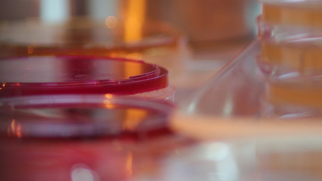  Asociación de Laboratorios Clínicos demandan al DS 