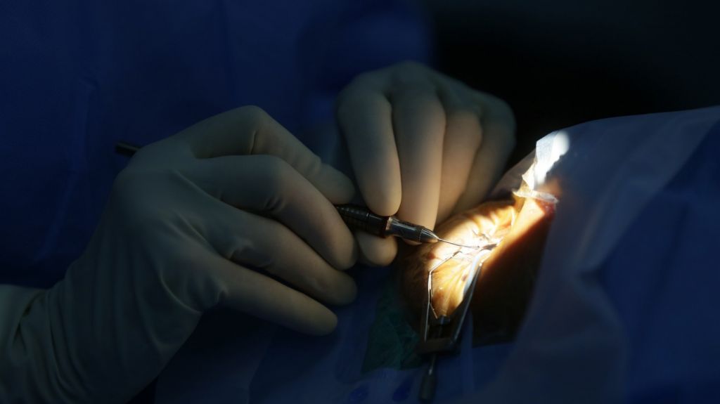  Sociedad Puertorrique&ntilde;a Oftalmolog&iacute;a avisa de seguridad visual por fiestas 