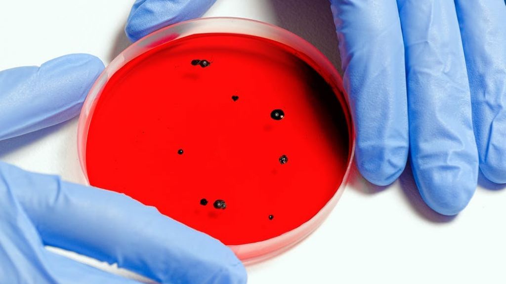  Cient&iacute;ficos desarrollan prueba r&aacute;pida y econ&oacute;mica para diagnosticar el COVID-19 