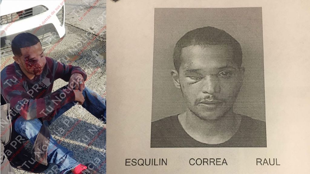  De centro m&eacute;dico para la c&aacute;rcel asaltante que cogi&oacute; un tiro en el ojo durante robo en Carolina 