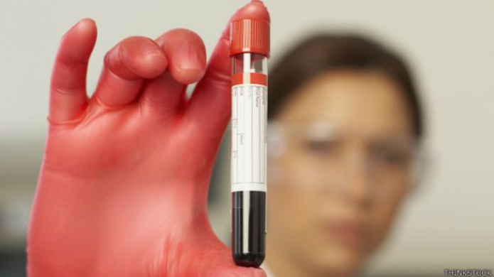 Terapia de vampiro: por quÃ© es bueno tomar tu propia sangre