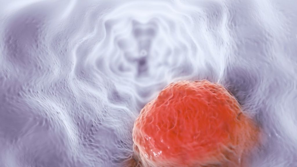  Descubren que una medicina ya en venta podr&iacute;a bloquear la propagaci&oacute;n del c&aacute;ncer 