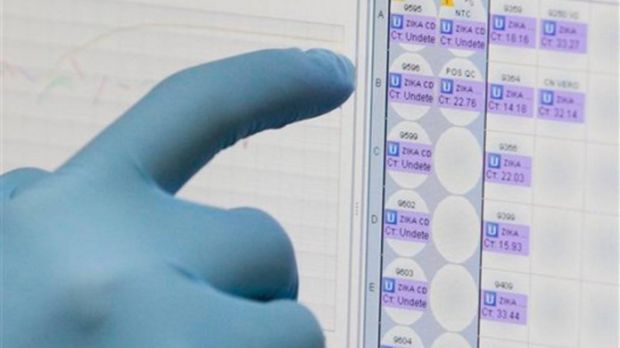 Autorizan en EEUU anÃ¡lisis de sangre experimental para zika