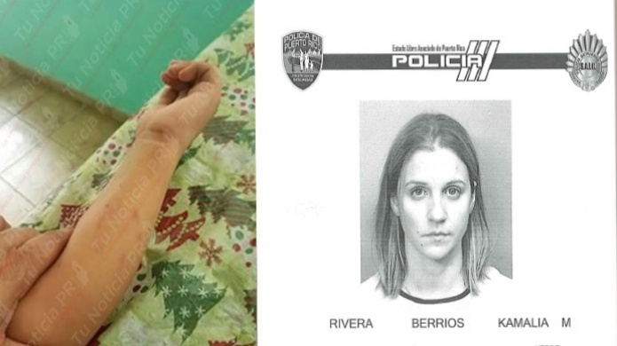  "Fichada" y bajo fianza maestra que mordiÃ³ un estudiante autismo severo en Corozal 