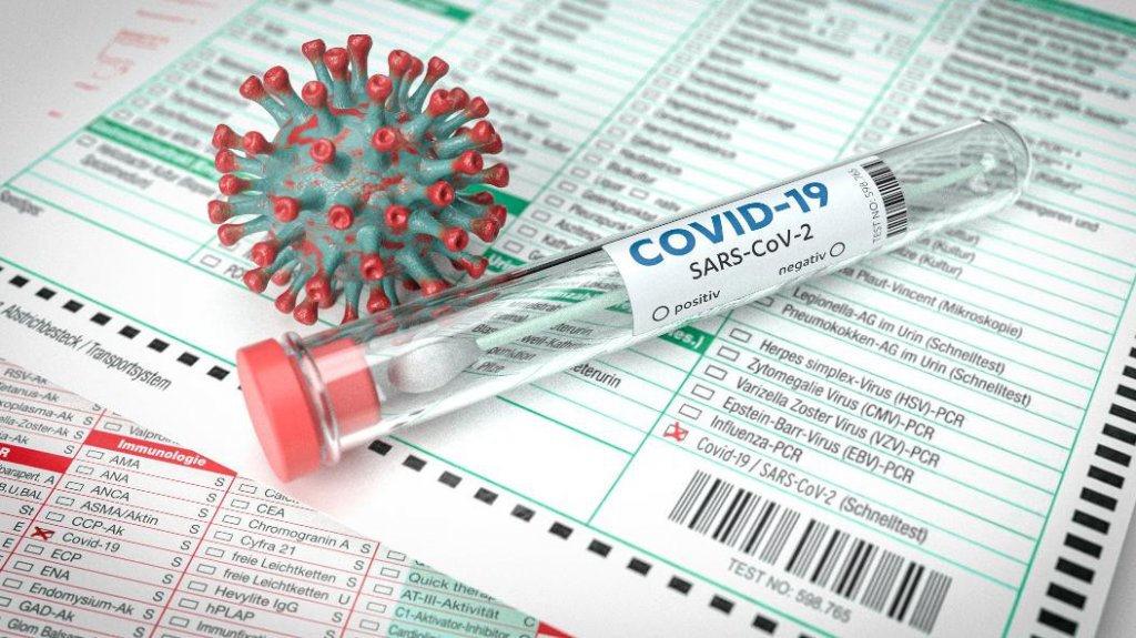  Departamento de Salud reporta dos muertes y 47 nuevas hospitalizaciones por Covid-19 