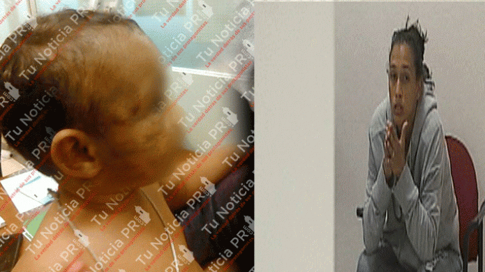 Cargos contra la mujer que permitiÃ³ golpiza a su bebe de 10 meses en Naguabo