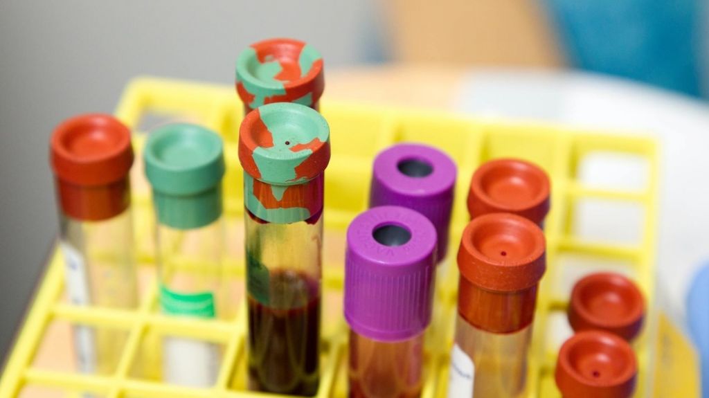  Cient&iacute;ficos rusos planean registrar varias vacunas contra el covid-19 en agosto y septiembre 