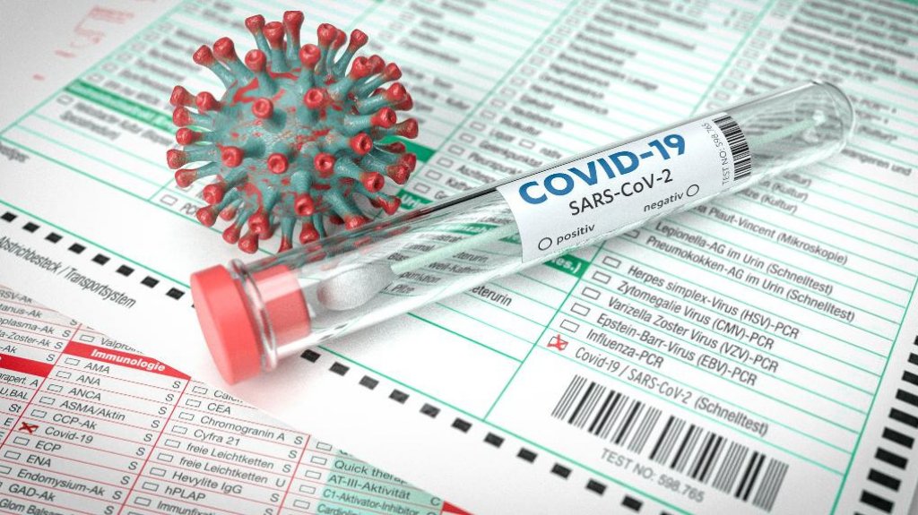  Salud reporta aumento de casos y otra muerte por COVID 19 