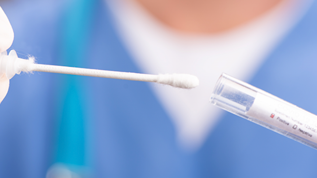  Municipio de Vega Baja realiza pruebas en Tortuguero y por servicarro 