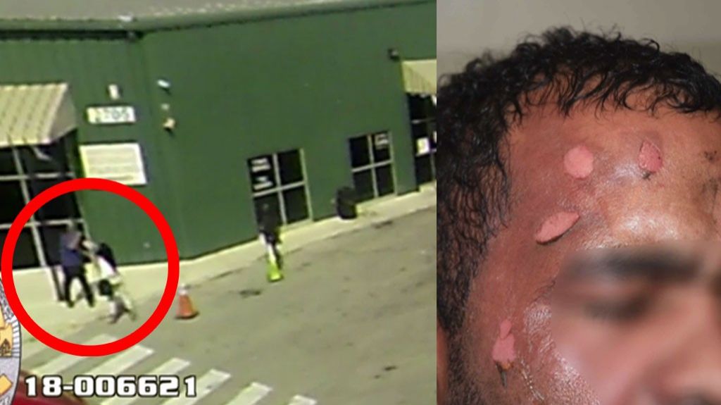  Video: Empleada quema a jefe con agua hirviendo tras ser acusada de robar 