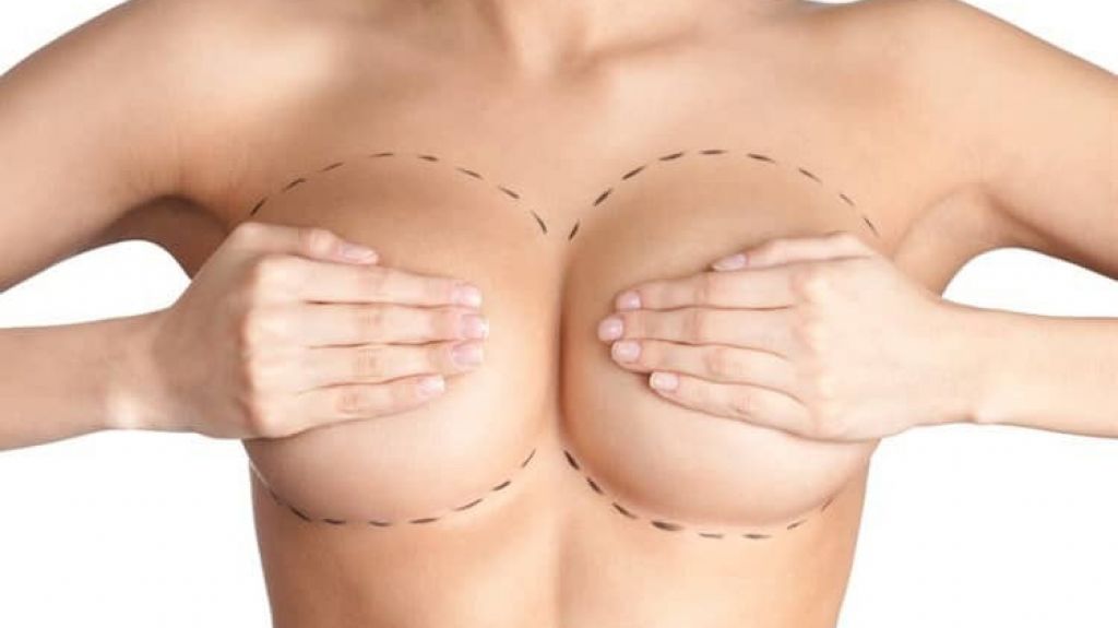  Foto: Una joven muere tras una cirug&iacute;a de aumento de pecho y la familia es presionada para pagar por la operaci&oacute;n 