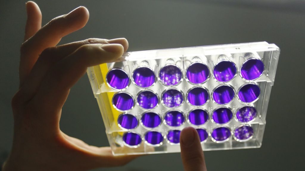  La cura para el covid-19 podr&iacute;a estar en un antiviral desarrollado originalmente contra el &eacute;bola 