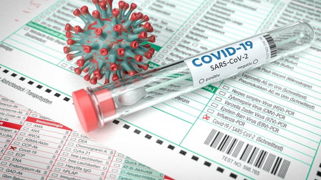  Salud no reporta muertes adicionales pero hospitalizados llegan a 98 y los contagiados, a 269 