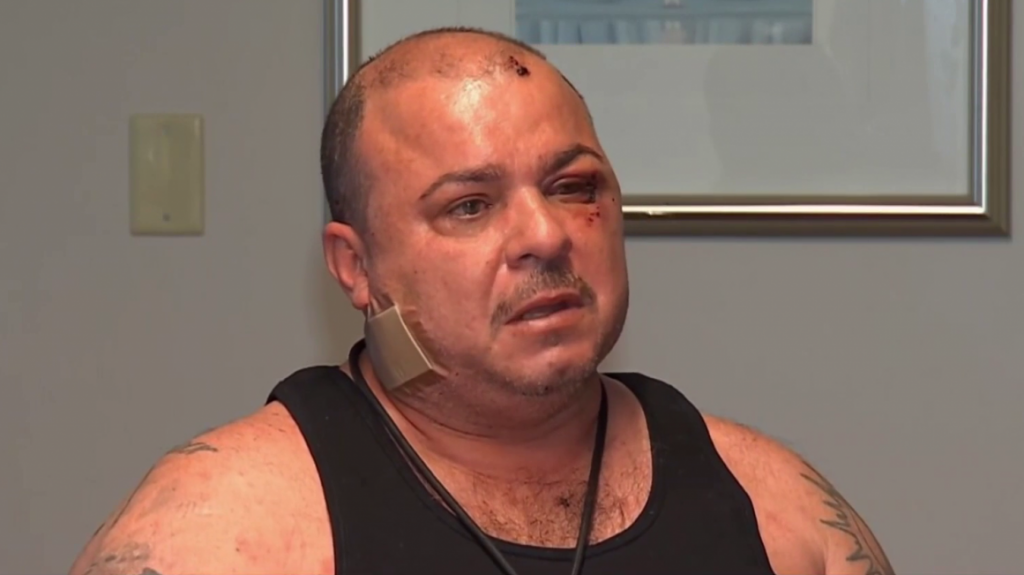  Sargento de la polic&iacute;a herido durante el tiroteo en Mayag&uuml;ez cuenta lo que sucedi&oacute; 