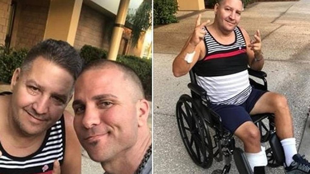  Fue de visita a Cuba y en el hospital le curaron una herida con vinagre. Regres&oacute; con una pierna amputada 