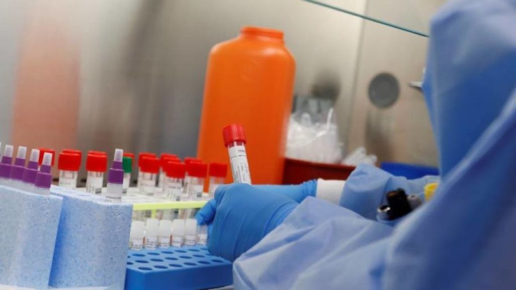  El número de contagios sube a 13,989, con 332 nuevos las últimas horas, y 456 defunciones 