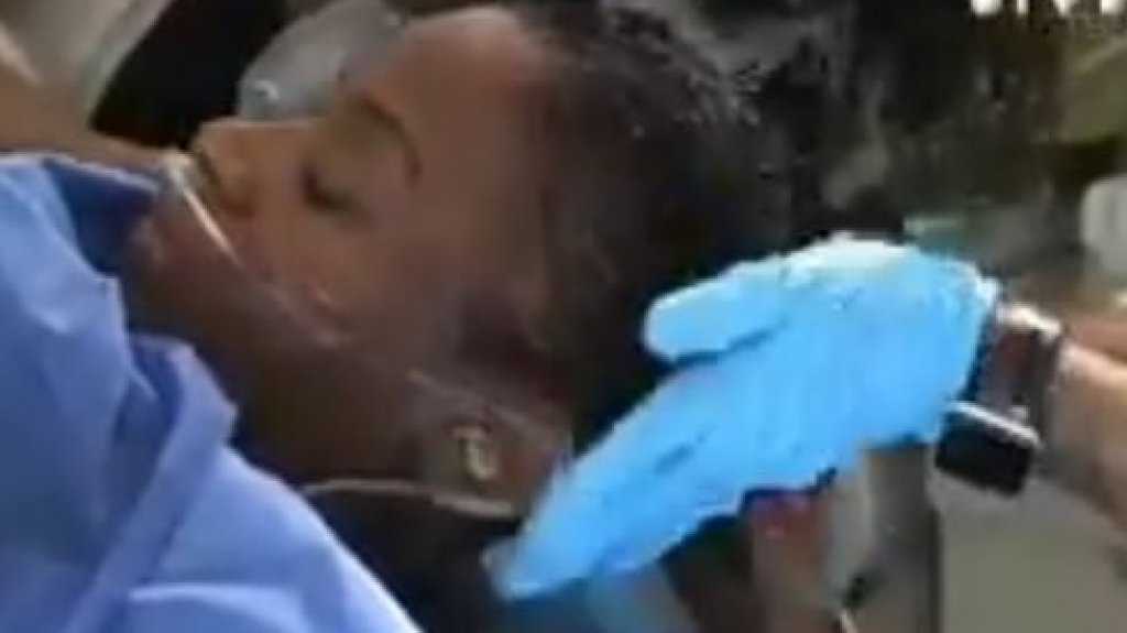  Video: Cirujano pl&aacute;stico logra quitarle el pegamento a una mujer de su pelo 