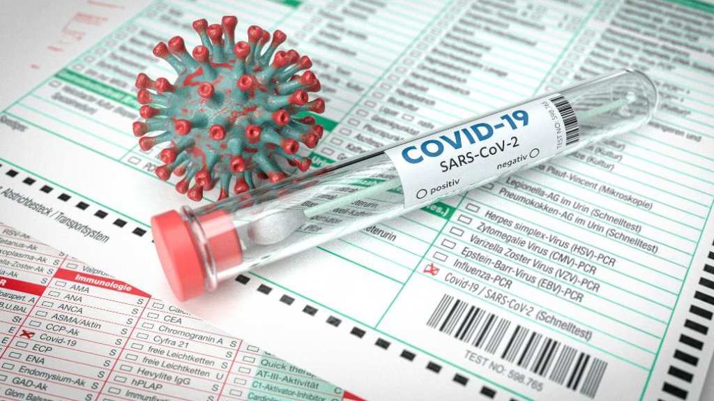  Salud reporta cero muertes, 45 personas hospitalizadas y 29 nuevos casos positivos 