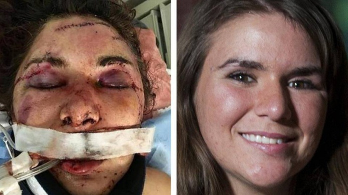 IncreÃ­ble recuperaciÃ³n de vÃ­ctima de brutal golpiza en Miami