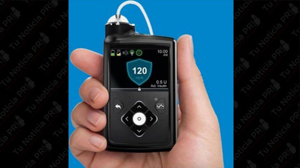  Innovadora tecnología mejora calidad de vida de pacientes con Diabetes tipo 1 