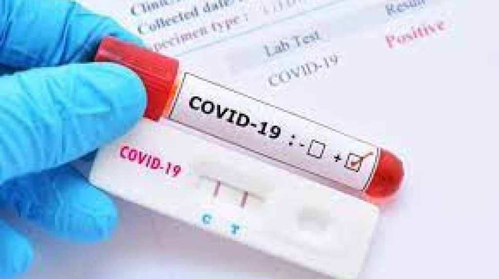  &iquest;Pruebas caseras de COVID-19 dan seguridad para las fiestas? 