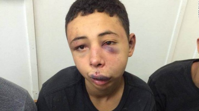 Un adolescente estadounidense es golpeado y arrestado en JerusalÃ©n