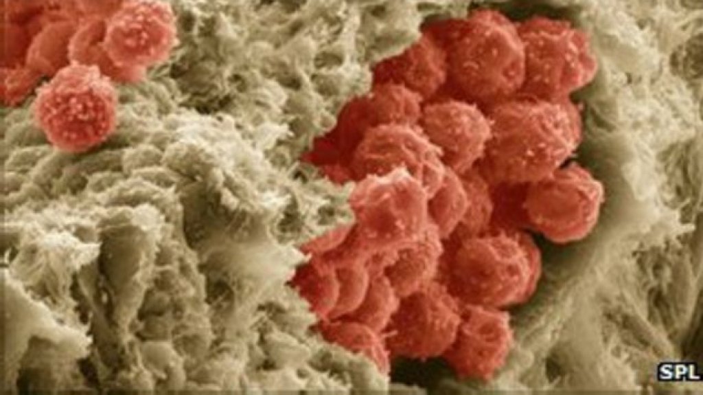  Avalan informe de proyecto de ley que crear&iacute;a el Banco P&uacute;blico de C&eacute;lulas Madre 