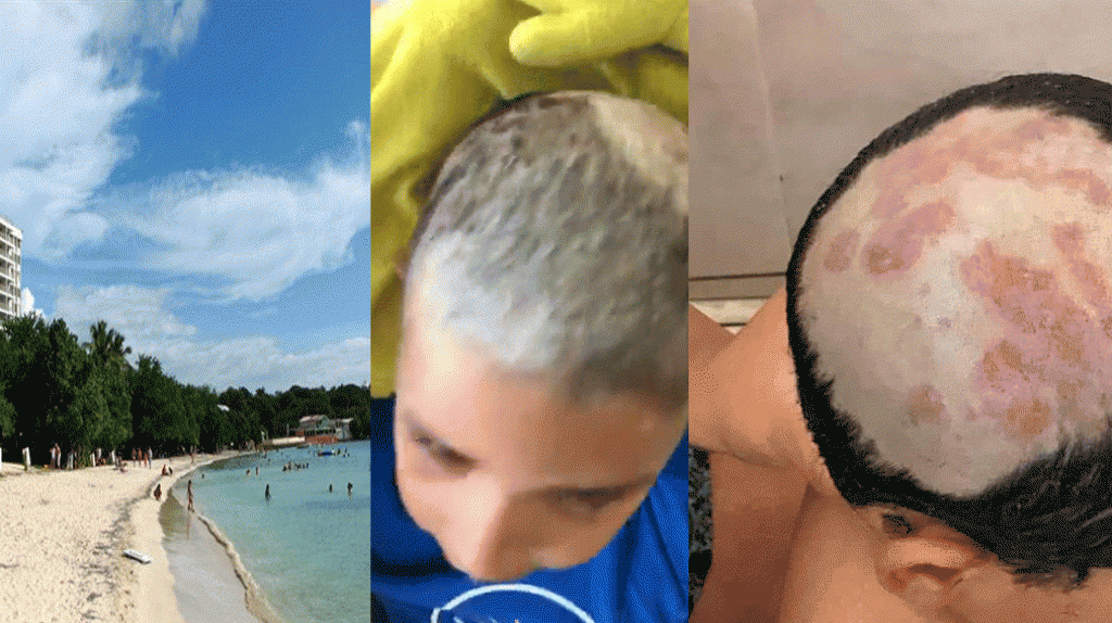  Secretaria de Recursos Naturales aclara sobre el estado de Playa Santa, por video de alegada bacteria que afect&oacute; un menor 