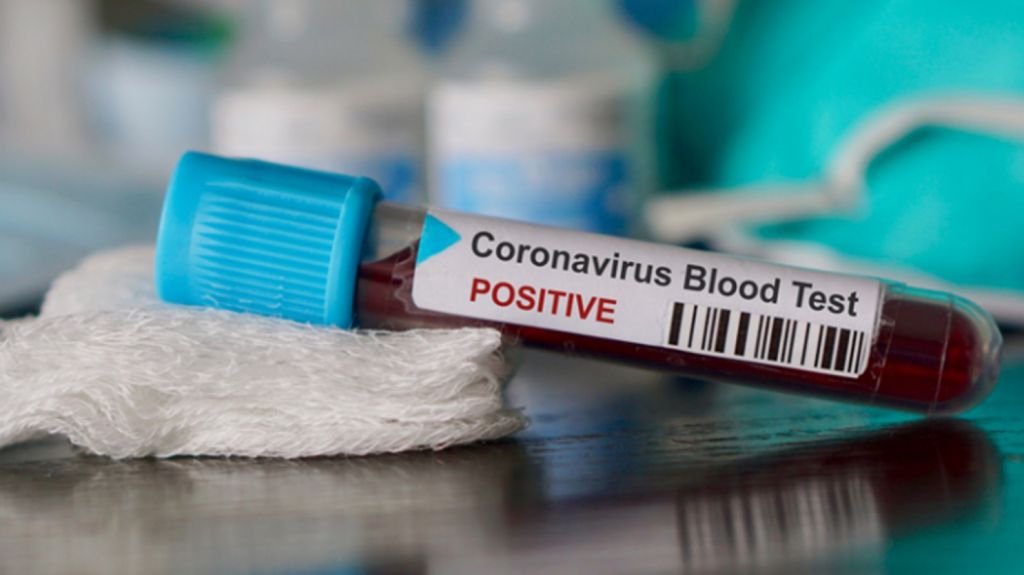  Aumentan a 31 los casos deCOVID-19 